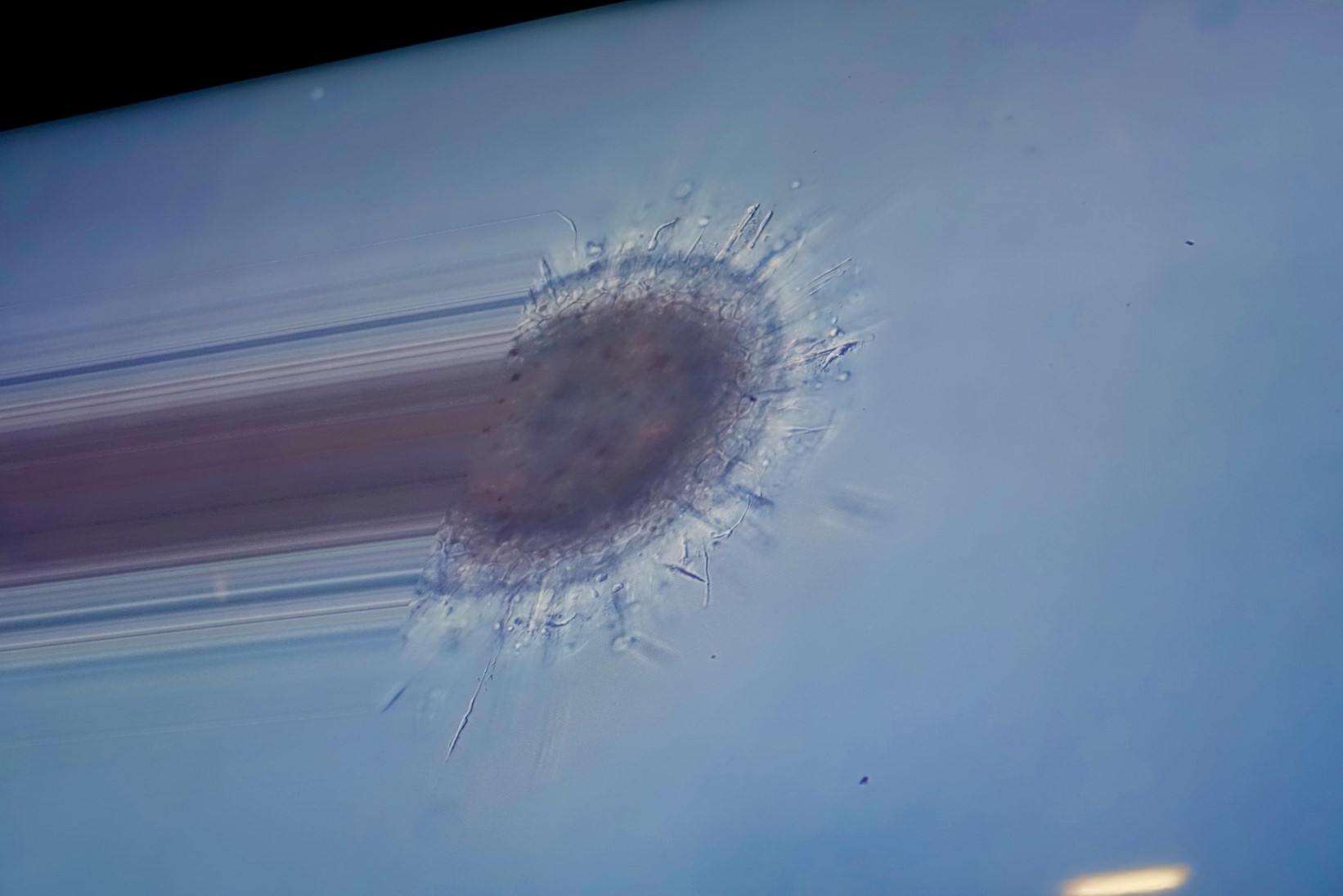 vue d'une bactérie au microscope en SVT 3ème