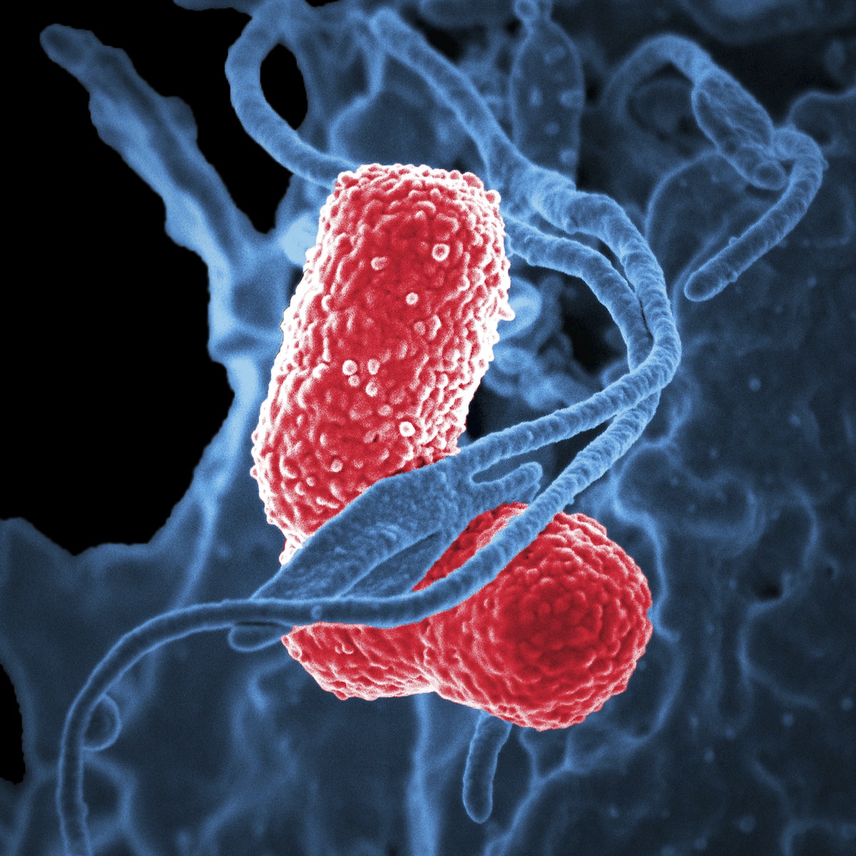 observation au microscope d'un virus dans le corps humain